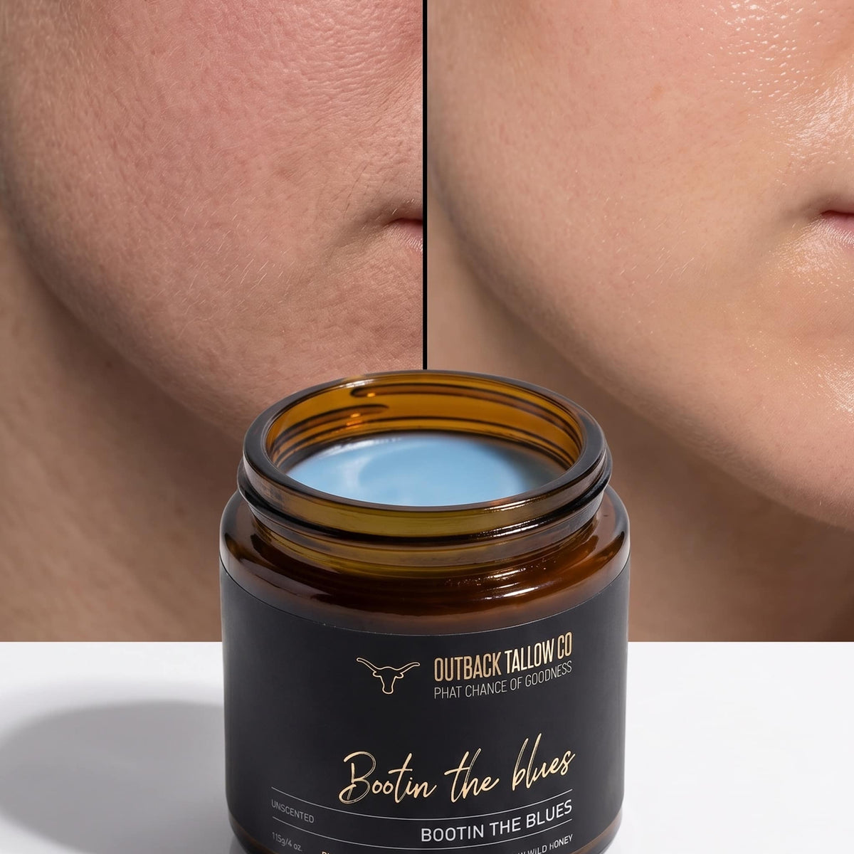 Bootin the Blues blue tansy grass-fed beef tallow balm for sensitive skin eczema psoriasis and rosacea jar alongside closeup of calm clear skin  natural skincare no synthetic fragrance fast shipping Australia wide – Outback Tallow Co Townsville Queensland Australia
